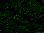 MCM2 Antibody in Immunohistochemistry (PFA fixed) (IHC (PFA))