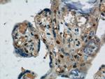 MCM2 Antibody in Immunohistochemistry (Paraffin) (IHC (P))