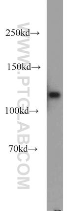 MCM2 Antibody in Western Blot (WB)