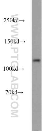 MCM2 Antibody in Western Blot (WB)