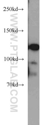 MCM2 Antibody in Western Blot (WB)