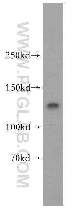 MCM2 Antibody in Western Blot (WB)