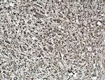 LASP1 Antibody in Immunohistochemistry (Paraffin) (IHC (P))