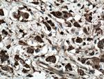 LASP1 Antibody in Immunohistochemistry (Paraffin) (IHC (P))