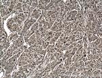 LASP1 Antibody in Immunohistochemistry (Paraffin) (IHC (P))