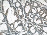 LASP1 Antibody in Immunohistochemistry (Paraffin) (IHC (P))