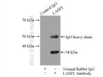 LASP1 Antibody in Immunoprecipitation (IP)