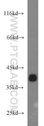 LASP1 Antibody in Western Blot (WB)