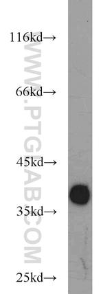 LASP1 Antibody in Western Blot (WB)