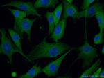 PACSIN2 Antibody in Immunocytochemistry (ICC/IF)