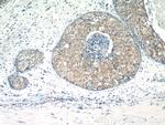 PACSIN2 Antibody in Immunohistochemistry (Paraffin) (IHC (P))