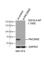 PACSIN2 Antibody in Western Blot (WB)