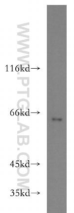 PACSIN2 Antibody in Western Blot (WB)