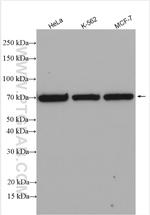 IFNAR2 Antibody in Western Blot (WB)