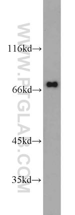 IFNAR2 Antibody in Western Blot (WB)