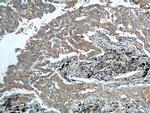 RRM1 Antibody in Immunohistochemistry (Paraffin) (IHC (P))