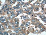 RRM1 Antibody in Immunohistochemistry (Paraffin) (IHC (P))