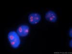 DDX21 Antibody in Immunocytochemistry (ICC/IF)