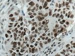 DDX21 Antibody in Immunohistochemistry (Paraffin) (IHC (P))