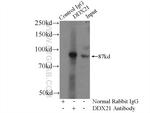 DDX21 Antibody in Immunoprecipitation (IP)