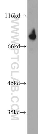 DDX21 Antibody in Western Blot (WB)