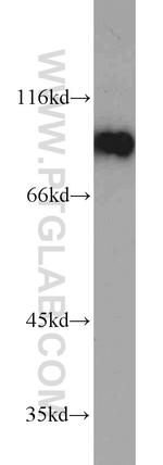 DDX21 Antibody in Western Blot (WB)