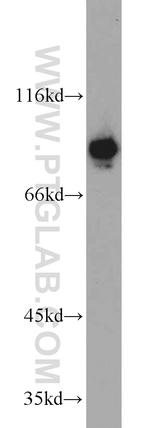 DDX21 Antibody in Western Blot (WB)