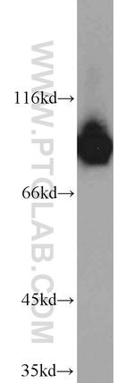 DDX21 Antibody in Western Blot (WB)