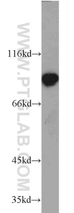 DDX21 Antibody in Western Blot (WB)