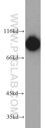 DDX21 Antibody in Western Blot (WB)