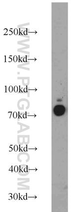 DDX21 Antibody in Western Blot (WB)