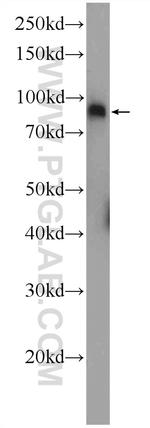 DDX21 Antibody in Western Blot (WB)