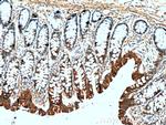 Chromogranin A Antibody in Immunohistochemistry (Paraffin) (IHC (P))