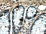 Chromogranin A Antibody in Immunohistochemistry (Paraffin) (IHC (P))