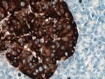 Chromogranin A Antibody in Immunohistochemistry (Paraffin) (IHC (P))