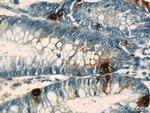 Chromogranin A Antibody in Immunohistochemistry (Paraffin) (IHC (P))