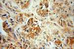 PDLIM5 Antibody in Immunohistochemistry (Paraffin) (IHC (P))