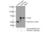 PDLIM5 Antibody in Immunoprecipitation (IP)