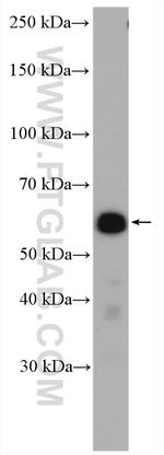 PDLIM5 Antibody in Western Blot (WB)