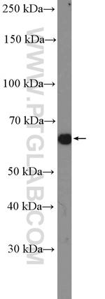 PDLIM5 Antibody in Western Blot (WB)