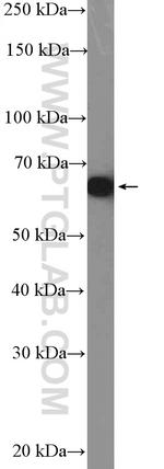 PDLIM5 Antibody in Western Blot (WB)