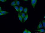 DAD1 Antibody in Immunocytochemistry (ICC/IF)