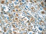 IL21R Antibody in Immunohistochemistry (Paraffin) (IHC (P))