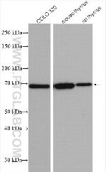 IL21R Antibody in Western Blot (WB)