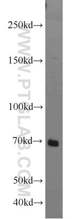 IL21R Antibody in Western Blot (WB)