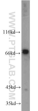 IL21R Antibody in Western Blot (WB)