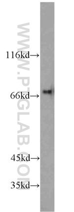 IL21R Antibody in Western Blot (WB)