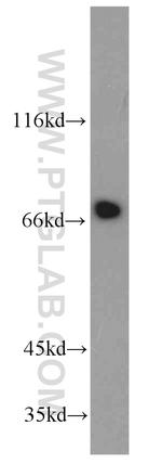 IL21R Antibody in Western Blot (WB)