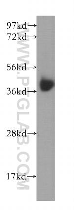 B4GALT7 Antibody in Western Blot (WB)