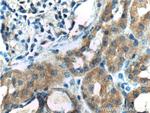 DDR1 Antibody in Immunohistochemistry (Paraffin) (IHC (P))